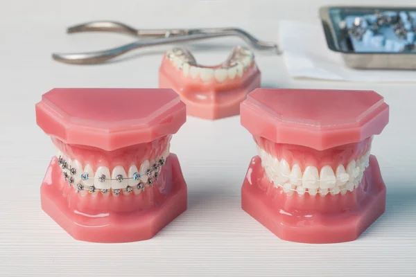 Dentures and braces — Stock Photo, Image