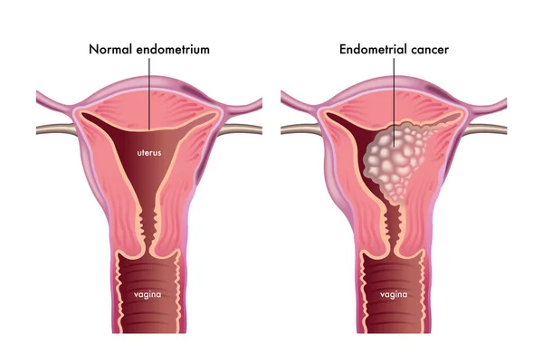 Vector Illustration Female Reproductive System White Background — 图库矢量图片