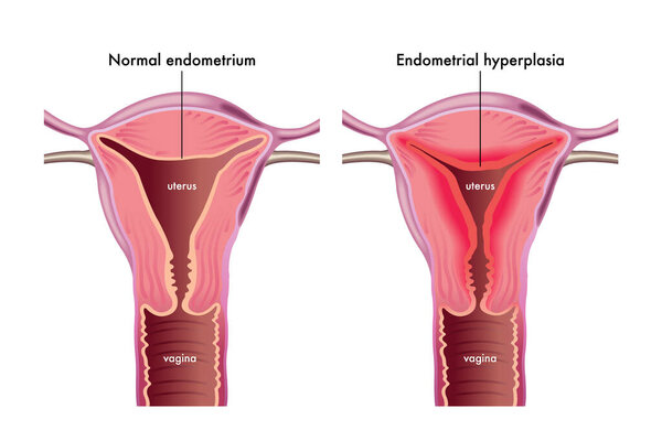 vector illustration of a female reproductive system on white background