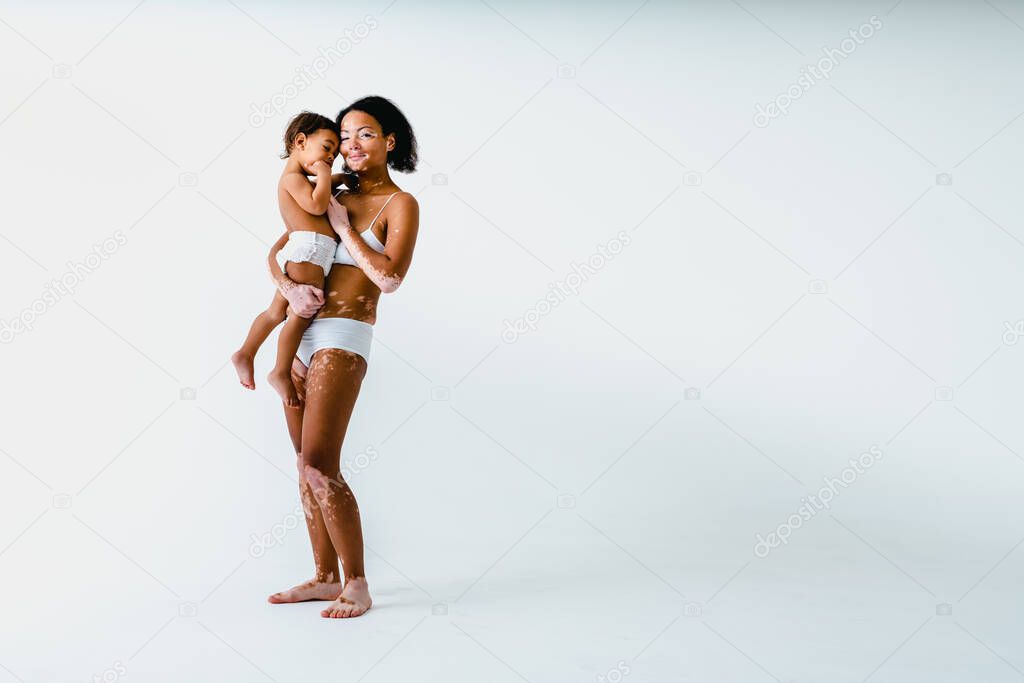 Happy black woman with vitiligo holding her baby  on colored background -  Young woman wearing underwear taking care of her little son  - Pregnancy, motherhood, people and expectation concept