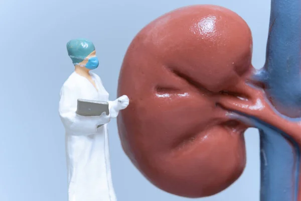 Miniature People Doctor Analyzing Patient Kidney Health Science Medical Concepts — Stock Photo, Image