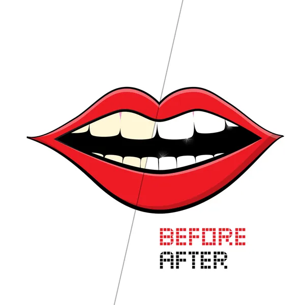 Vector Mouth on White Background. Cleaning Teeth, Before and After. — Stock Vector