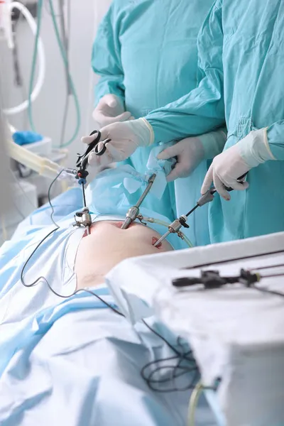 Chirurgia Laporoskopowa Celu Usunięcia Przepukliny Pachwinowej Nowoczesne Wyposażenie Chirurgiczne Przepuklina — Zdjęcie stockowe