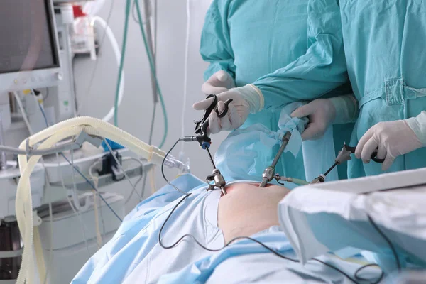 Chirurgia Laporoskopowa Celu Usunięcia Przepukliny Pachwinowej Nowoczesne Wyposażenie Chirurgiczne Przepuklina — Zdjęcie stockowe