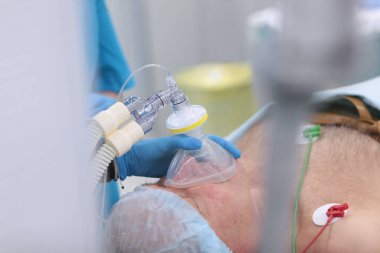 Ameliyattan önce genel anesteziye giriş. Hastanın yüzünde bir nefes maskesi. Tıbbi anestezi. Operasyon için hazırlık. Bir hayat kurtarıyorum. Bağış konsepti. Tanınmayan biri..