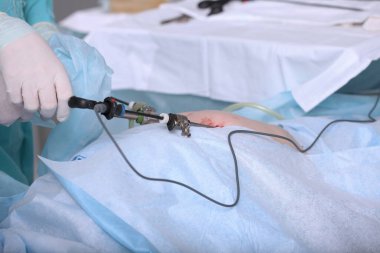 Laparoskopik ameliyat. Gerçek bir operasyon. Fıtık çıkarma. Sağlığın korunması. Modern ameliyat. Sadece cerrahın elleri..