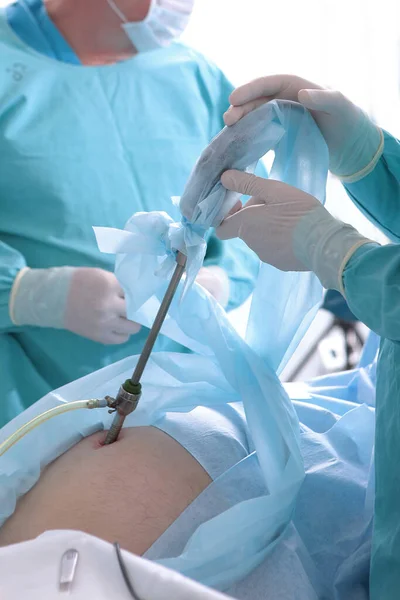 Cirurgia Laparoscópica Instrumentos Médicos Nas Mãos Dos Médicos Medicina Moderna — Fotografia de Stock