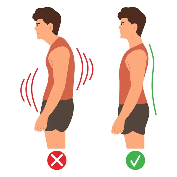 正确和不正确的站立姿势 颈椎曲率 Hump 健康的背影 白色背景的矢量图解 — 图库矢量图片