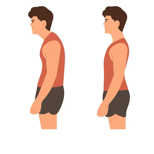 Postura Pie Correcta Incorrecta Curvatura Columna Cervical Hump Ilustración Vectorial — Vector de stock