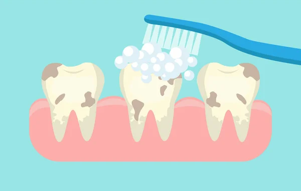 Ağız temizliği, diş temizliği..