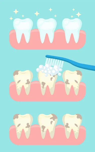  Sağlıklı beyaz diş ikonu. Kötü sarı dişler. Diş fırçası ve köpük köpüğü. İnfografiden önce. Ağız temizliği..