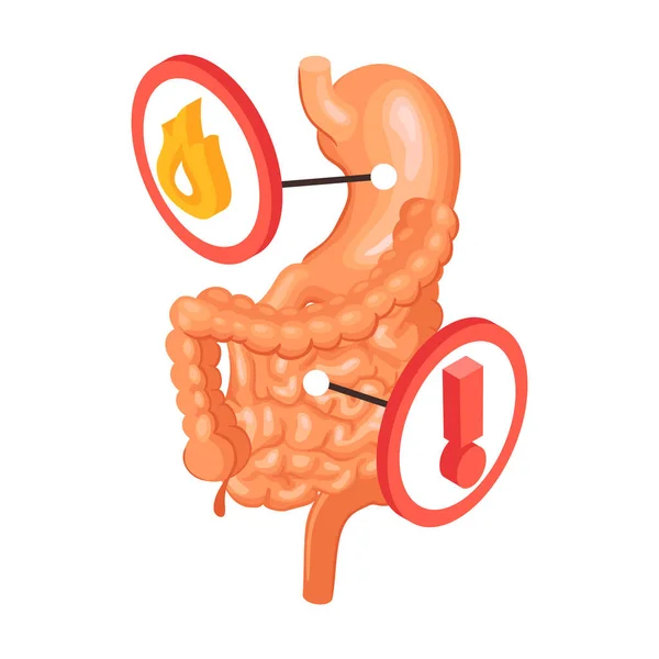 Gastroenterologiska problem med att hitta sammansättningen — Stock vektor