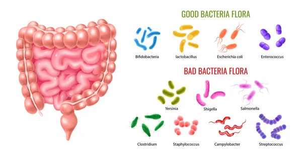 Infografías de la flora bacteriana del colon bueno y malo — Vector de stock
