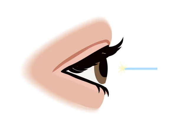 Composition de la correction de la vue laser — Image vectorielle