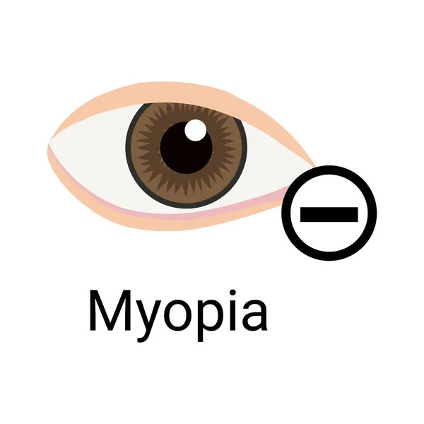 Miopia Composição Cuidados com os olhos — Vetor de Stock