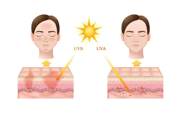 Anatomie kůže Sluneční záření Infographics — Stockový vektor