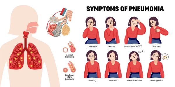 Symptoms Of Pneumonia Infographics — стоковый вектор