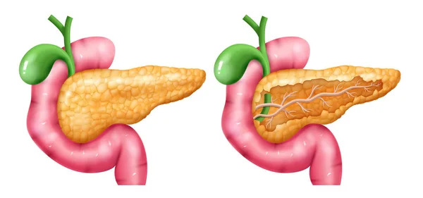 Conjunto de ícones de pâncreas realista — Vetor de Stock