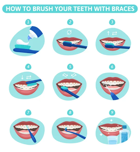 Kebersihan Gigi Set Rata Bulat Komposisi Infografis Menunjukkan Tahap Mulut - Stok Vektor