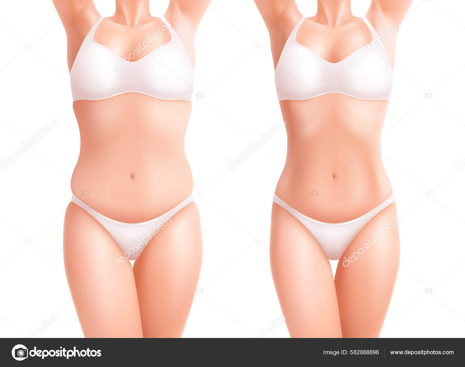 Feminino Peso Corpo Mulher Definido Com Antes Depois Visões Realistas  vetor(es) de stock de ©macrovector 582888896