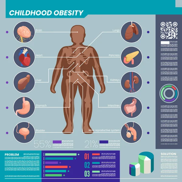Childhood Obesity Organs Infographic Set Healthcare Symbols Isometric Vector Illustration — Stok Vektör