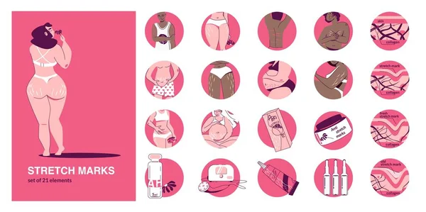 Stretch Marks Flat Set Compositions Cosmetic Product Icons Text Female — Archivo Imágenes Vectoriales