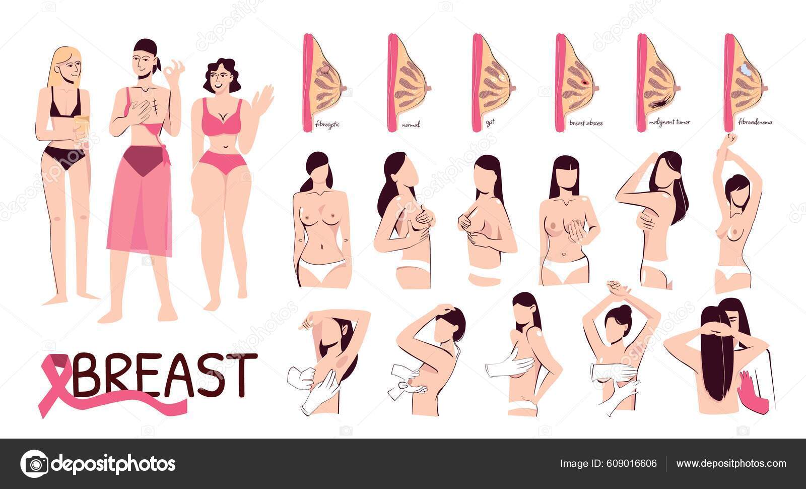 Breast Woman Flat Set Cross Sections Normal Ill Female Breast