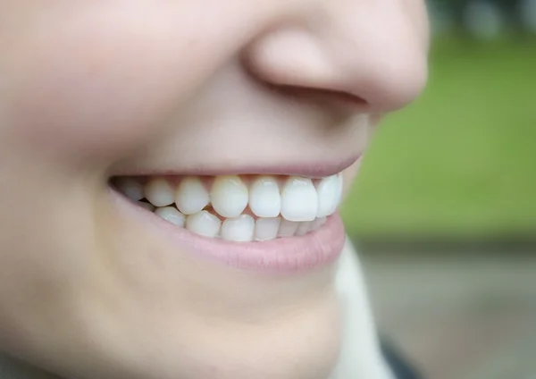 Primer plano de la mujer sonriendo con dientes blancos prefectos —  Fotos de Stock