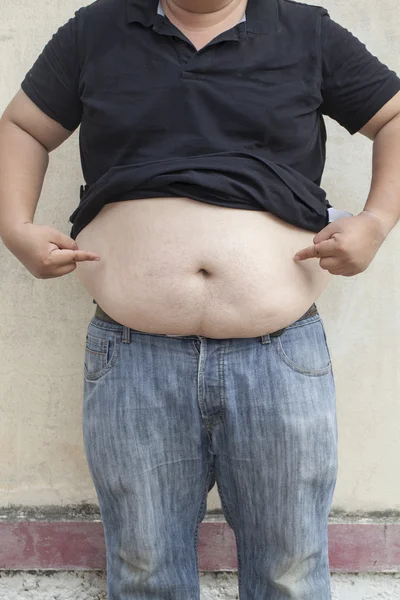 Hombre gordo con una gran barriga, parte del cuerpo de cerca — Foto de Stock
