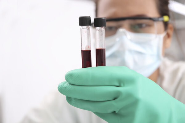 Closeup of a blurred female scientist looking at blood  in test 