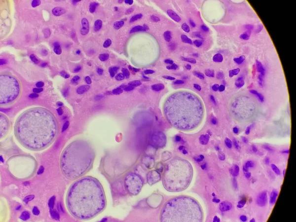 H ve E patoloji numunesinde Coccidioides imitis küreleri — Stok fotoğraf