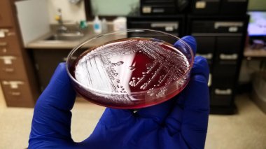 Salmonella kolonileriyle kan tarımı kültürü tabağı