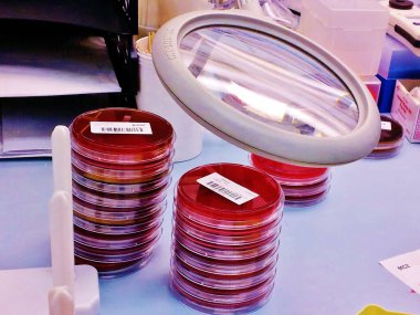 Mikro laboratuarda büyüteçle kan tarlası plakaları istiflenmiş.