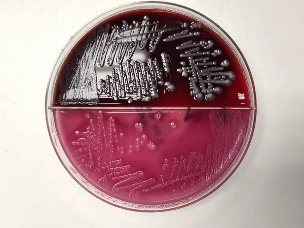 E. coli bacteria petri dish - blood and Macconkey agar