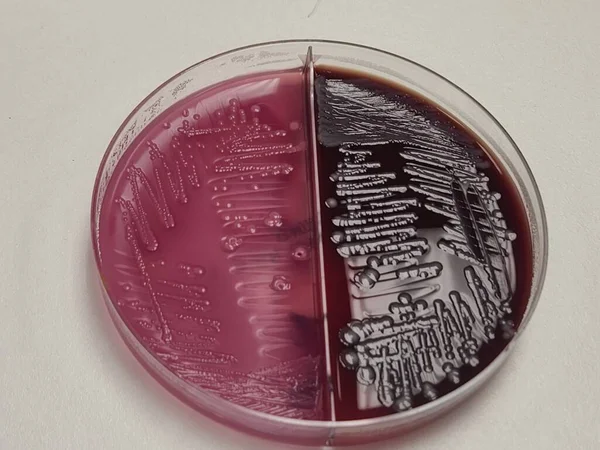 E. coli bacteria petri dish - blood and Macconkey agar