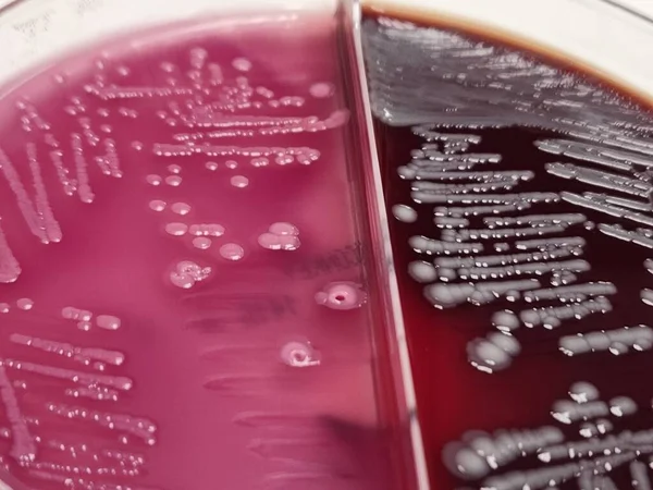 Bactérias Coli Placa Petri Sangue Ágar Macconkey — Fotografia de Stock