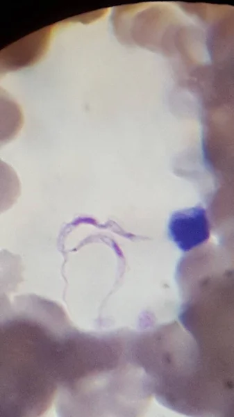 Trypanosoma Rodesiense Parassiti Che Nuotano Nel Sangue — Foto Stock