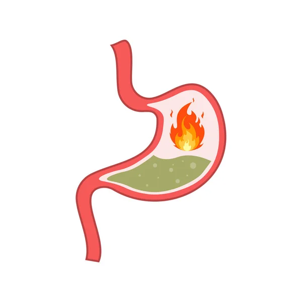 Reflusso Acido Bruciore Stomaco Gastrite Indigestione Mal Stomaco Concetto Problemi — Vettoriale Stock
