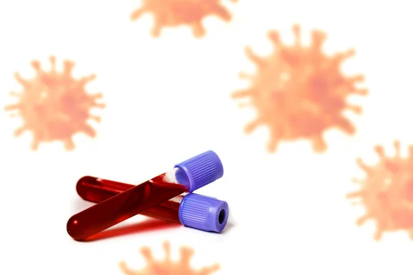 コロナウイルス細胞の飛行を背景に 血液検査を行う2つの検査管 — ストック写真