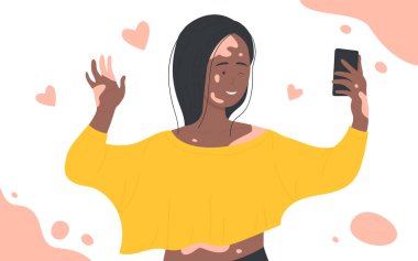 Cilt problemleri vitiligo, mutlu kız sosyal medya için selfie çekmek için cep telefonu kullanıyor