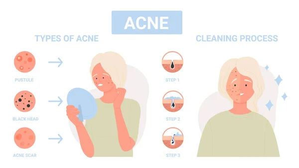 Type Acne Facial Skin Steps Infection Treatment Face Pores Infographic — Stockový vektor