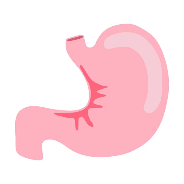 Estómago Humano Órgano Interno Anatomía Vector Ilustración Plano Diseño — Vector de stock