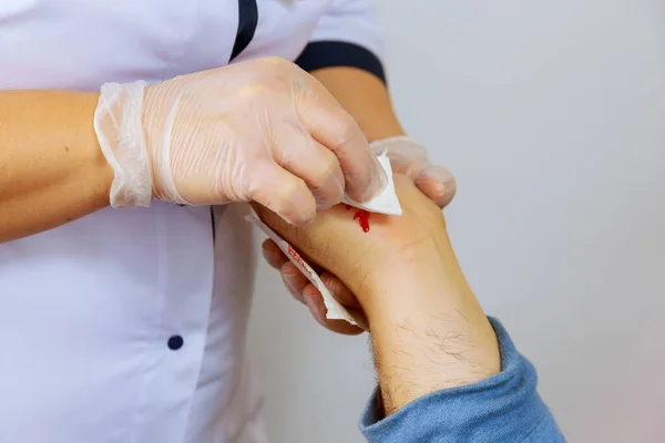 Una enfermera con guantes desinfecta la mano afectada del paciente, de la que fluye la sangre. — Foto de Stock