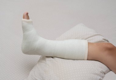 Kırık bacak. Ayak bileği ve ayak bandajları bacaklarda. Kapat.