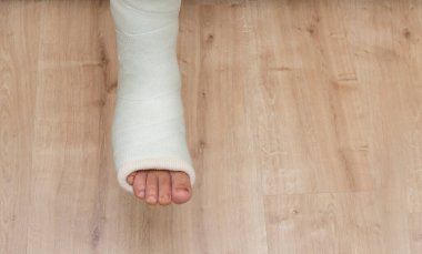 Kırık bacak. Ayak bileği ve ayak bandajları bacaklarda. Kapat.