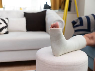Kırık bilek ve alçı. Bacak sabitleme
