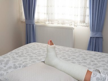 Kırık bilek ve alçı. Bacak sabitleme