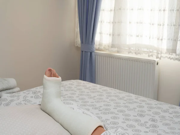 足首の骨折と脚のキャスト 脚部の裂傷 — ストック写真