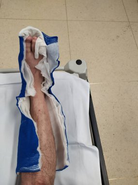 Hastanenin yaralı bacağı