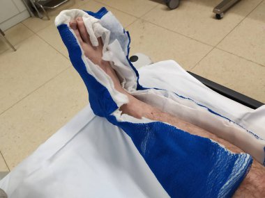 Hastanenin yaralı bacağı